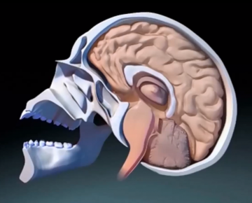Concussions: Impacts on the Brain